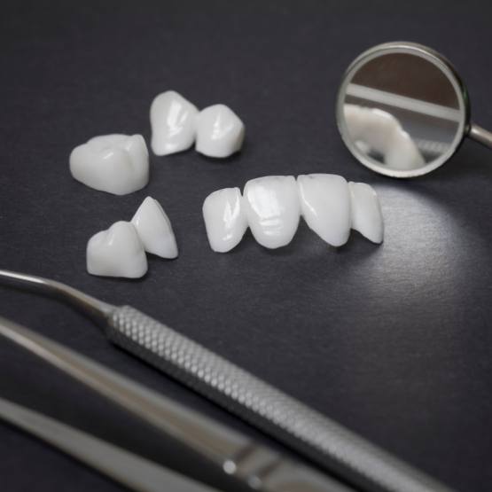 Several white dental crowns and veneers on table next to dental mirrors