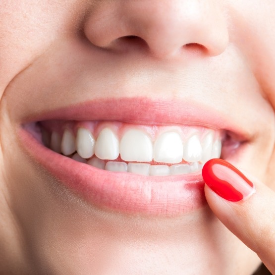 Close up of person pointing to their smile with flawless teeth