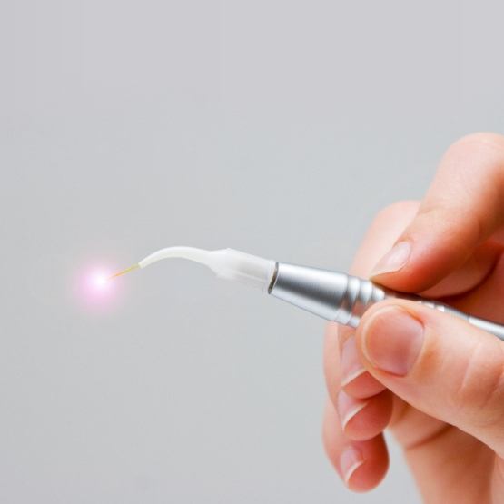 Hand holding a small dental laser device