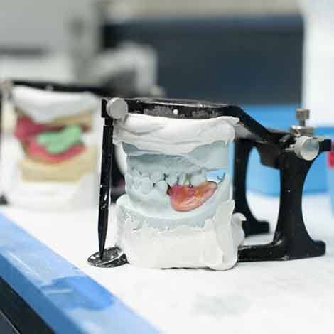 Dentures being crafted