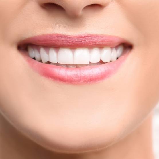 Close up of person smiling with straight white teeth