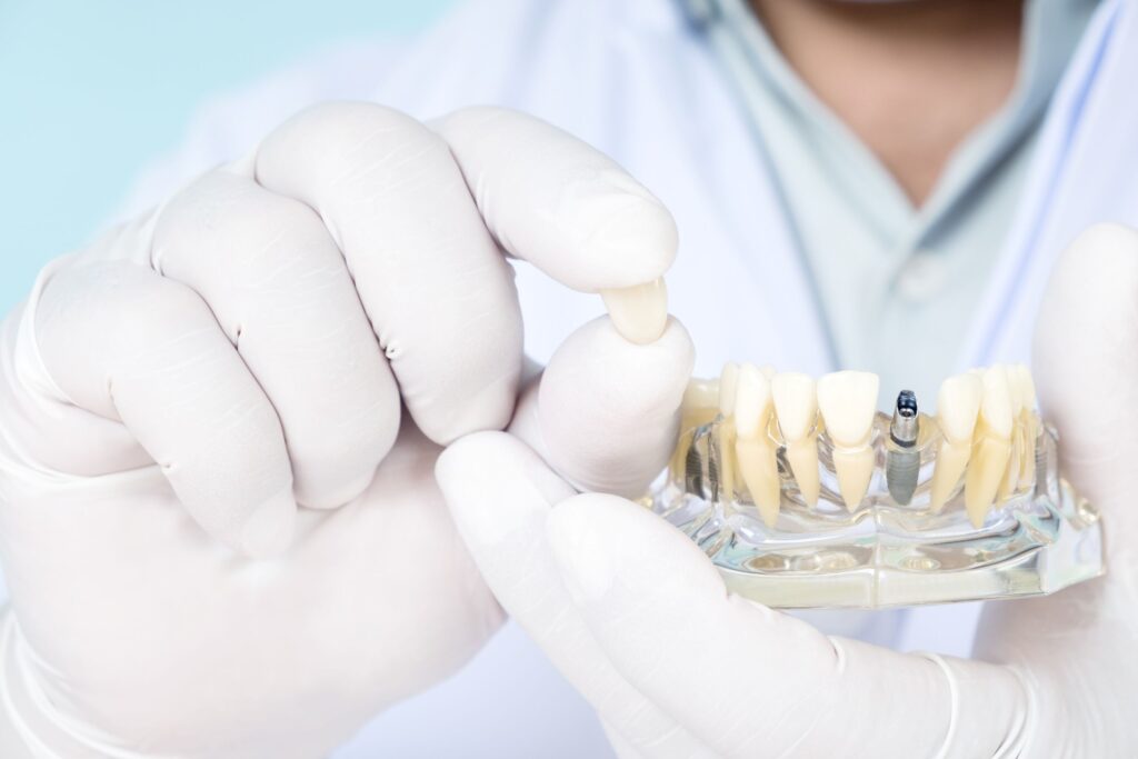 Dentist wearing white holding sample dental implant