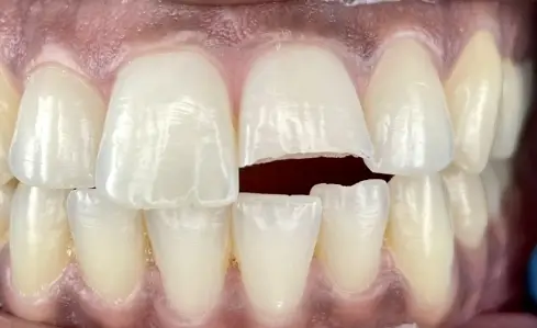 case 1 before smile gallery